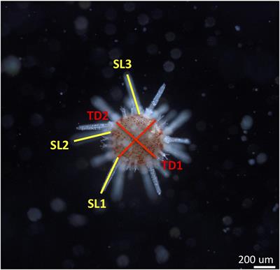 Diffusive Boundary Layers and Ocean Acidification: Implications for Sea Urchin Settlement and Growth